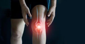 Image of a person with a knee injury