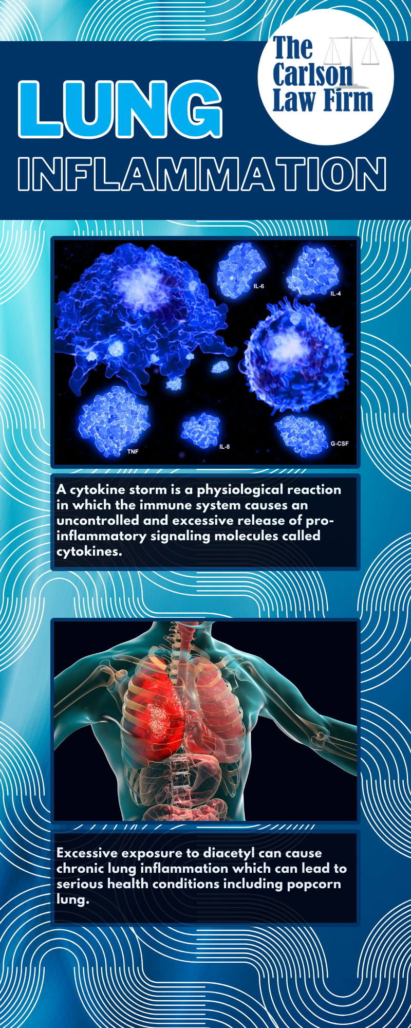 diacetyl can cause lung pulmonary inflammatory  responses