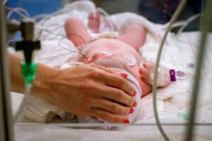 Image of newborn baby in the NICU