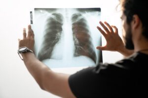 Image of person viewing a chest x-ray