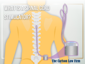 What is a spinal cord stimulator