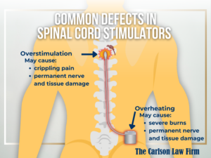 Graphic representation of common defects in spinal cord stimulators, electric defects, overstimulation, overheating