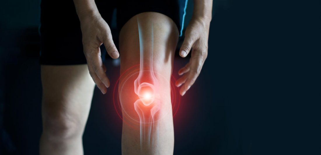 Image of a person with a knee injury