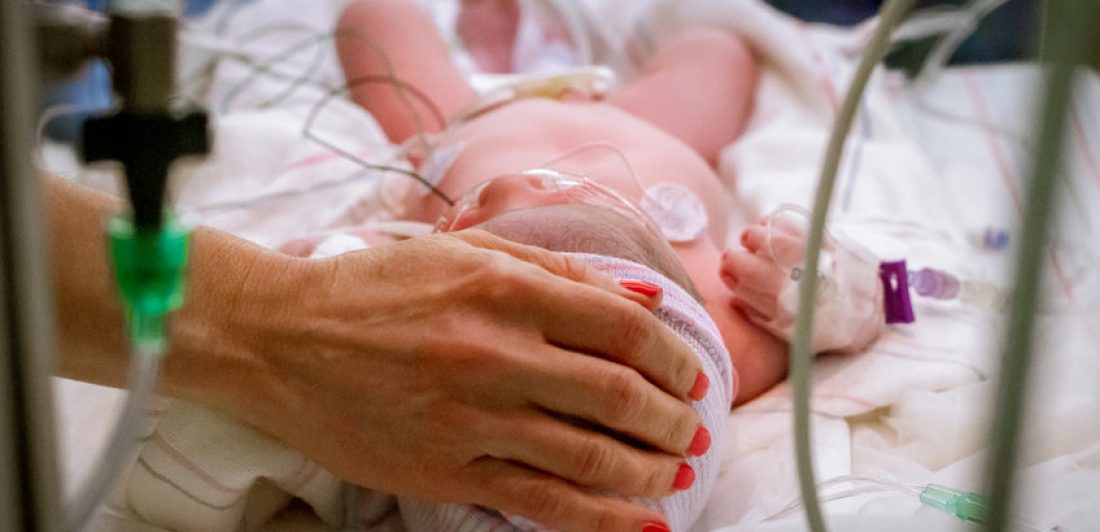 Image of newborn baby in the NICU