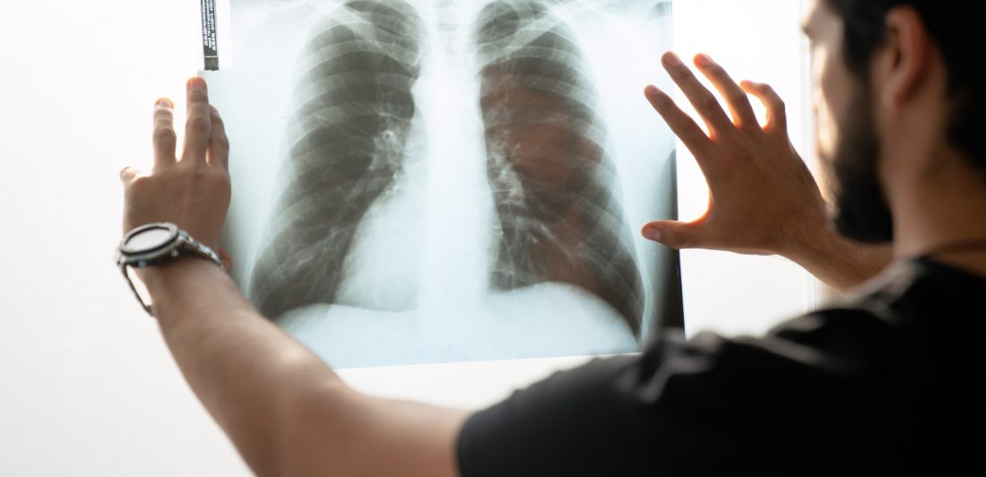 Image of person viewing a chest x-ray