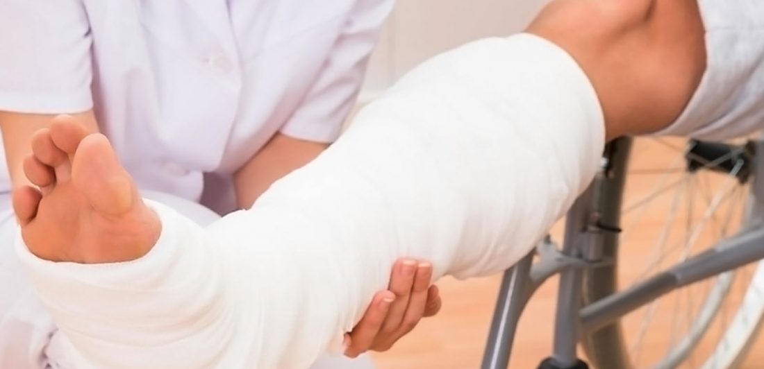 Image of a medical professional checking on a person with a leg cast in a wheel chair