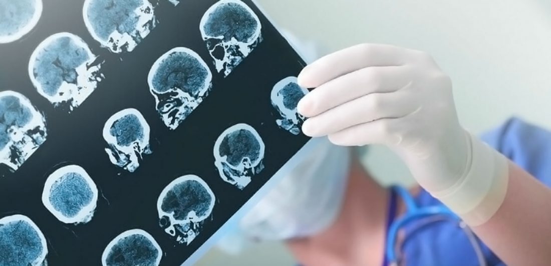 Image of gloved medical professional looking at radiology images of a brain